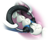 Composi-Tight® Soft Face™ 3D XR Ring