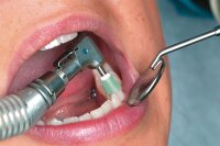 Garrison eZr Komplett-Set