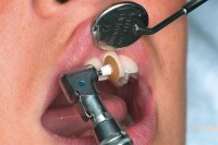 Garrison eZr Komplett-Set